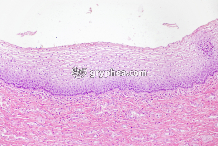 Muqueuse vaginale x40 - gryphea.com